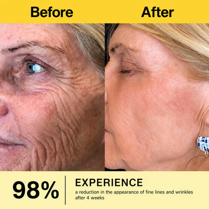 🔥🔥 Sabax® Wrinkle-Lift Tightening stick